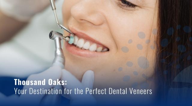 Thousand Oaks: Your Destination for the Perfect Dental Veneers