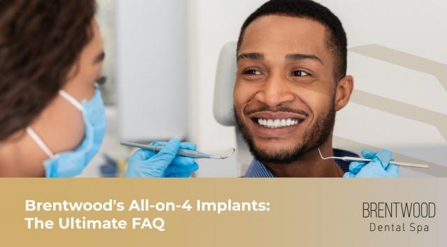 Brentwood's All-on-4 Implants: The Ultimate FAQ